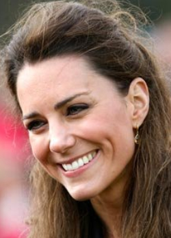 Kate Middleton legnagyobb szépséghibája