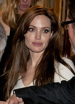 Angelina újra megműtette magát-fotó
