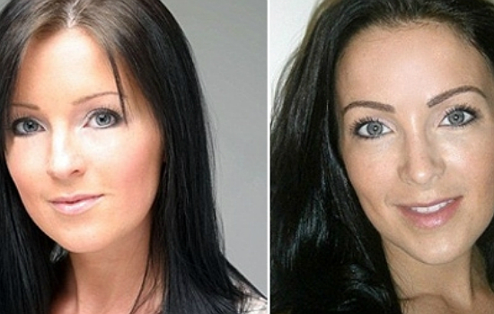 Műtét előtt és után