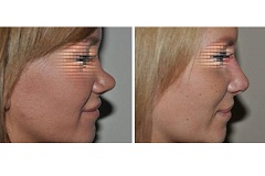 Őszi megújulás, átalakulás profi segítséggel