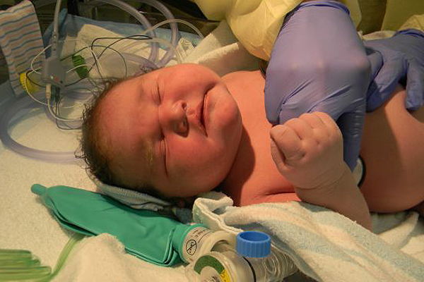 6,9 kilós babát szült egy filigrán kismama