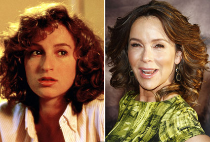 Sokkoló plasztikai műtétek Hollywoodból - fotók Sokkoló plasztikai műtétek Hollywoodból - fotók