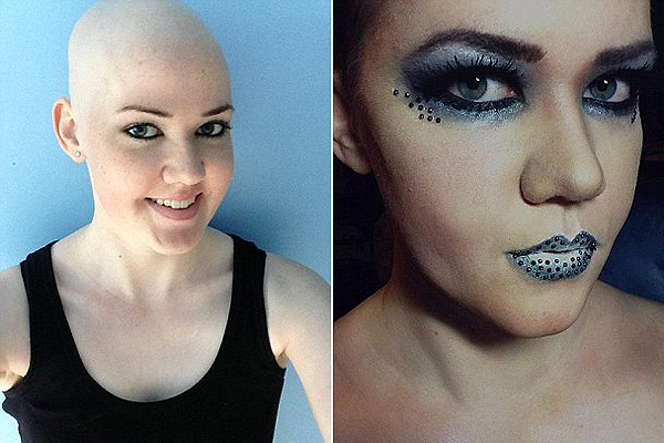 Szépségblogot ír a leukémiás lány