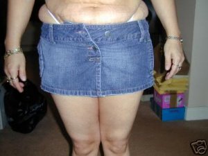 Fájdalmas divatbakik