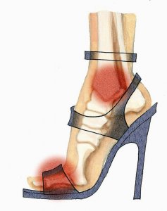 A magassarkú cipő története - bakik a vörös szőnyegen