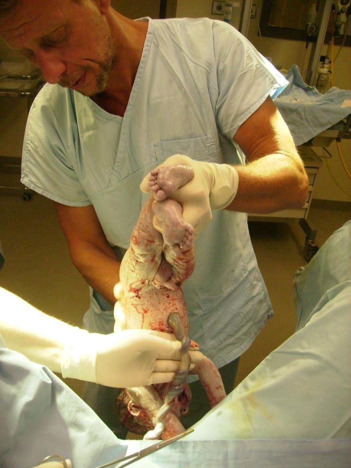 Mit jelent burokban születni? - csodás képek