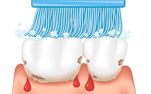 Hogyan őrizzük meg fogainkat egy egész életen át?
