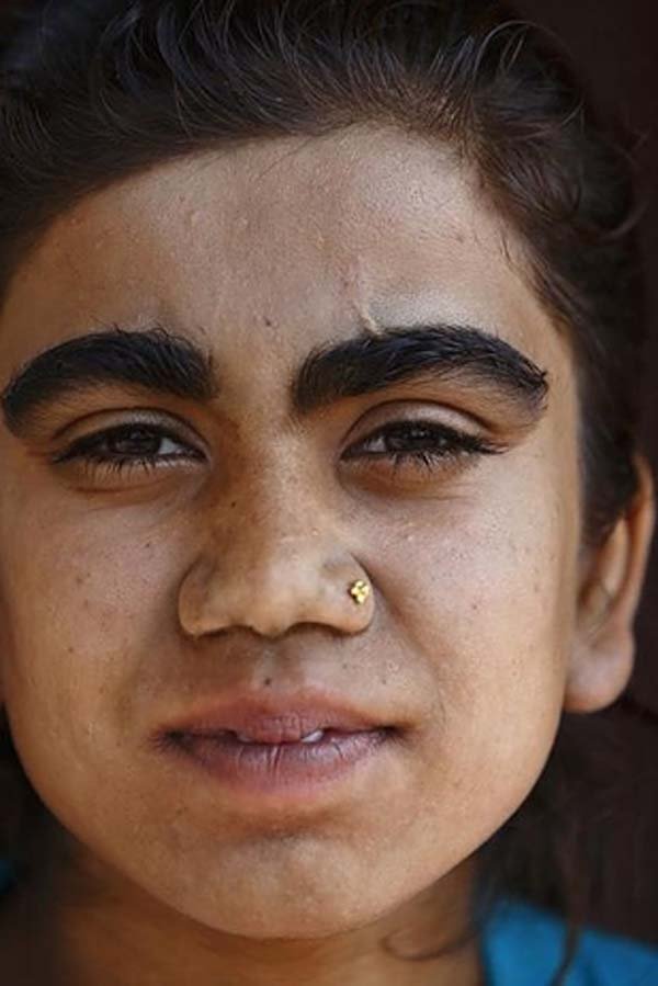 Egy vérfarkas szindrómás család átalakulása 