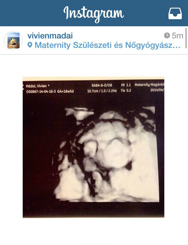 Fotó: Mádai Vivien Instagram oldala Fotó: Mádai Vivien Instagram oldala