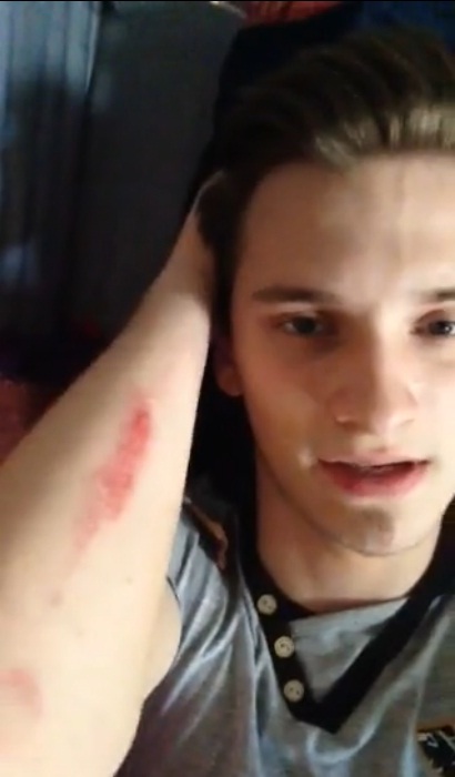 Baleset érte az X-Faktoros Tóth Marcit - fotó