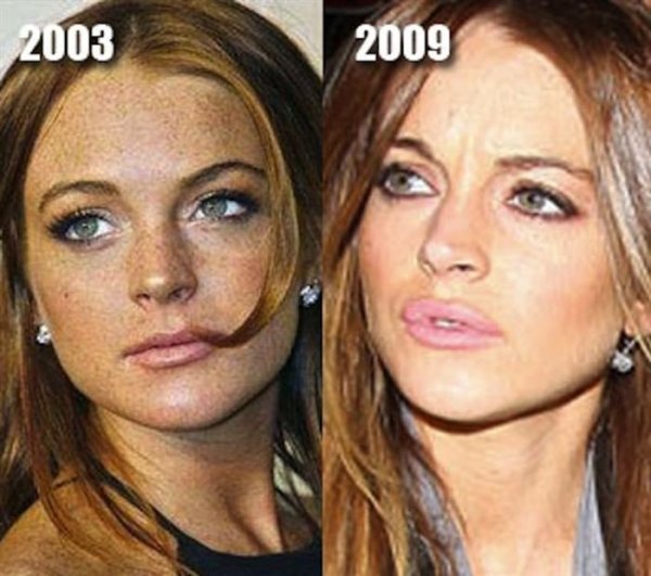 Plasztikai sebészek és celebek horrorisztikus ámokfutása