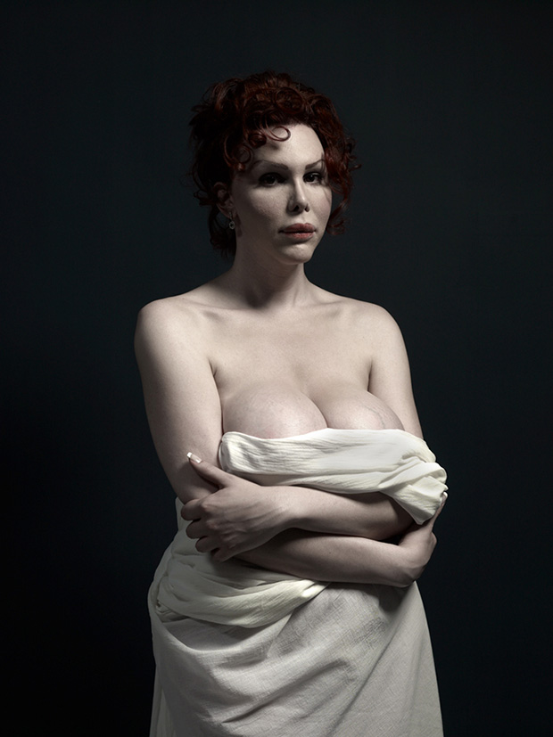 Extrém plasztika: a szépség új formája