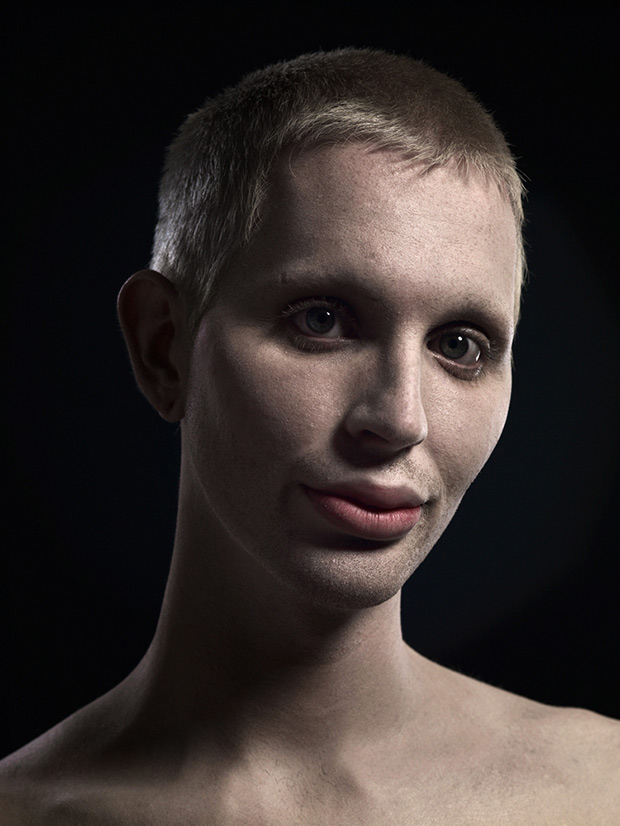 Extrém plasztika: a szépség új formája