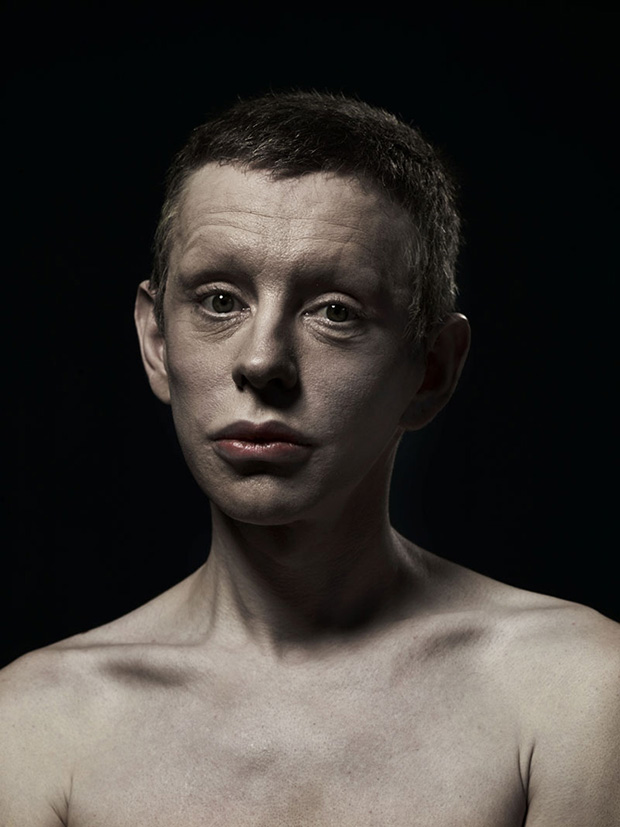 Extrém plasztika: a szépség új formája