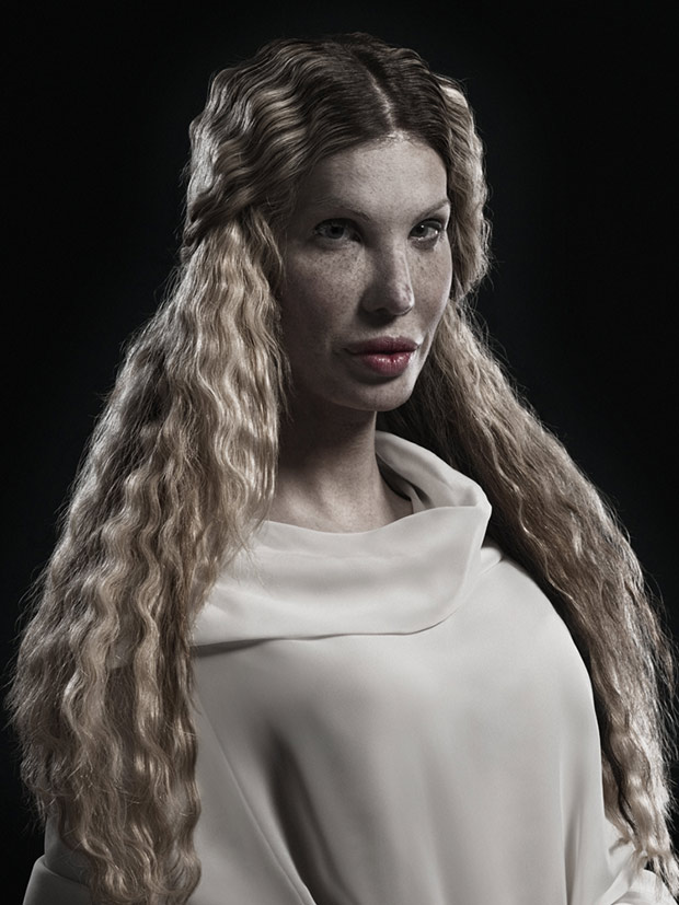 Extrém plasztika: a szépség új formája