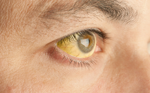 A hepatitis már itthon is támad