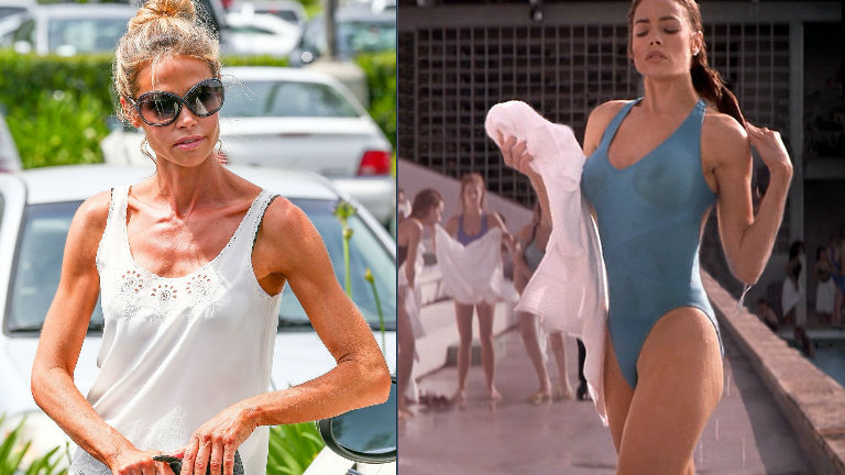 Sokkoló: mi történt Denise Richards testével?