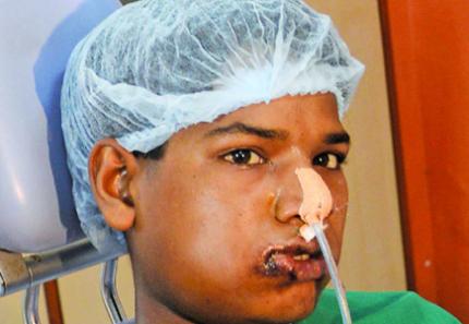 Forrás: asianage.com