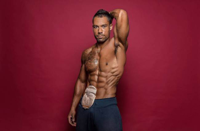 Sztómazacskóval lett szexi modell - fotók