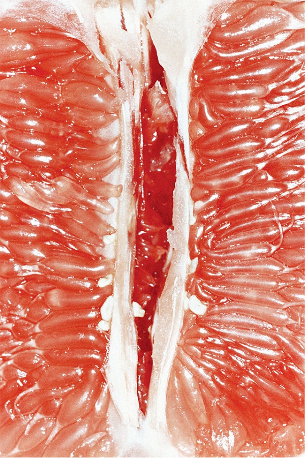 18+: 4 vaginát mintázó gyümölcs 18+: 4 vaginát mintázó gyümölcs