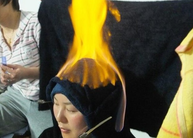 Bizarr kezelés: törölközőt égetnek az arcodon