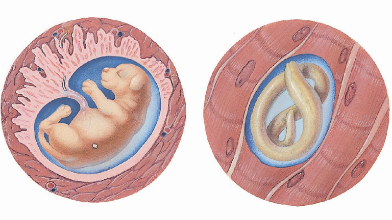 Gyerekekre is veszélyes a bélféreg