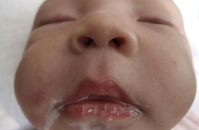 Így vált apává a férfi - képek