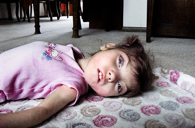 Négy év alatt egy évet öregszik egy kislány