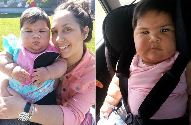 Ötéves méretűre nőtt egy tízhónapos kislány