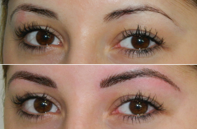 Szálazot szemöldök, előtte-utána