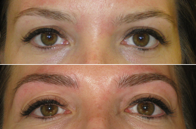 Szálazott szemöldök Artistry technikával