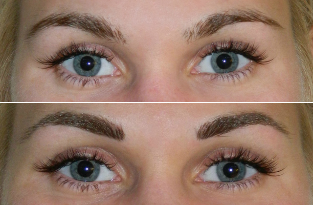 Előtte-utána, púderes hatású technikával