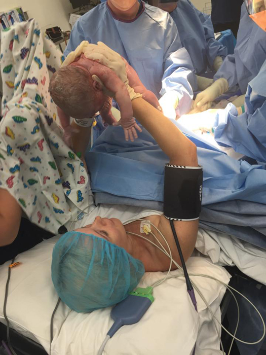 Saját császármetszésénél asszisztált az anya - fotók