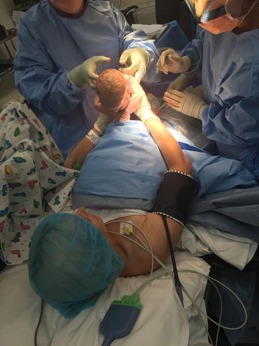 Saját császármetszésénél asszisztált az anya - fotók