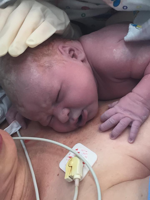 Saját császármetszésénél asszisztált az anya - fotók