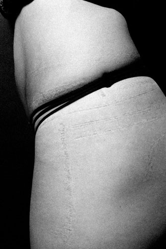 3 fotó: ezt teszik a testeddel a szoros ruhák