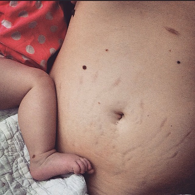 Szülés után az első hetek: nem csupa móka és kacagás