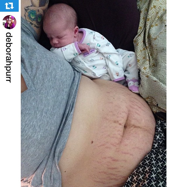 Szülés után az első hetek: nem csupa móka és kacagás