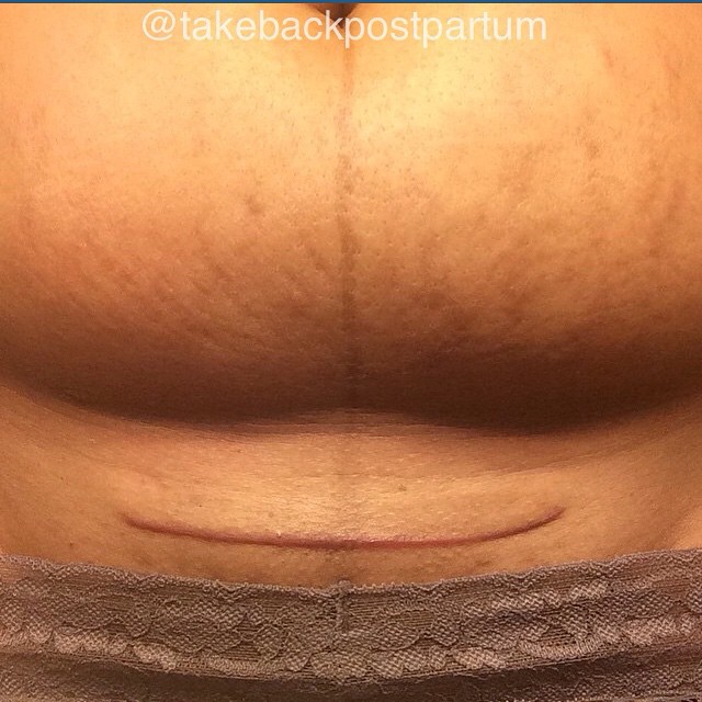 Szülés után az első hetek: nem csupa móka és kacagás