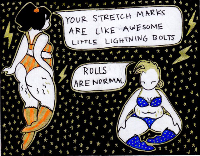 A striáid olyanok, mint a csodás kicsi villámok! A párnácskák normálisak