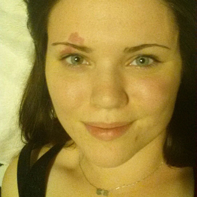 15 bizonyíték arra, hpogy az anyajegyek igenis szépek