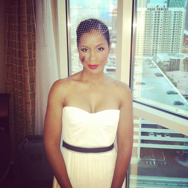 15 bizonyíték arra, hpogy az anyajegyek igenis szépek