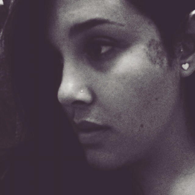 15 bizonyíték arra, hpogy az anyajegyek igenis szépek