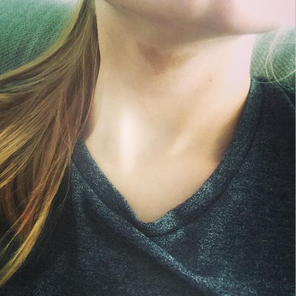 15 bizonyíték arra, hpogy az anyajegyek igenis szépek