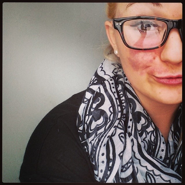 15 bizonyíték arra, hpogy az anyajegyek igenis szépek