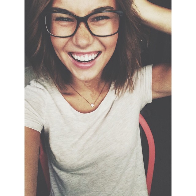 15 bizonyíték arra, hpogy az anyajegyek igenis szépek