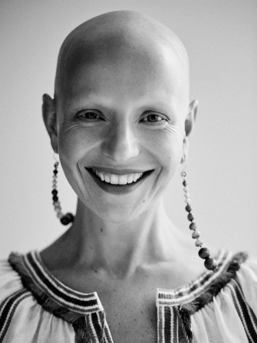 6 nő meséli el, hogyan veszítette el a haját - megható történetek