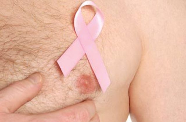 Amire nem gondolnák – emlőrák férfiaknál