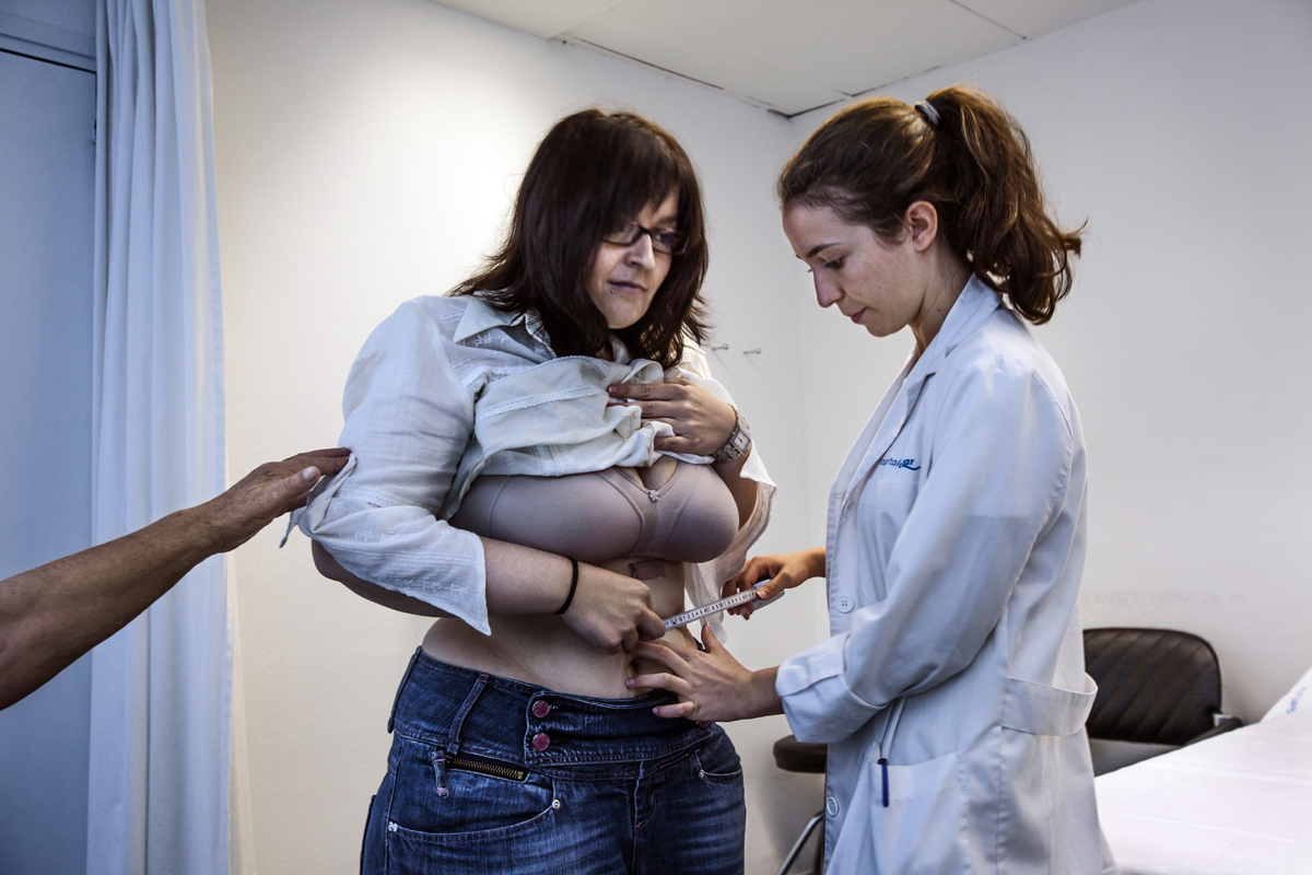 Több, mint 50 kilótól szabadult meg gyomorműtéttel a fiatal nő - fotók