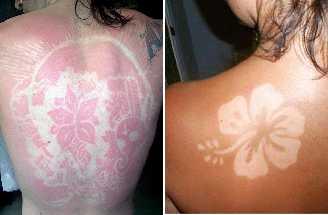 Bőrrákot lehet kapni az új divattól Bőrrákot lehet kapni az új divattól